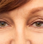 Возрастная катаракта: возможно ли предотвратить ее развитие